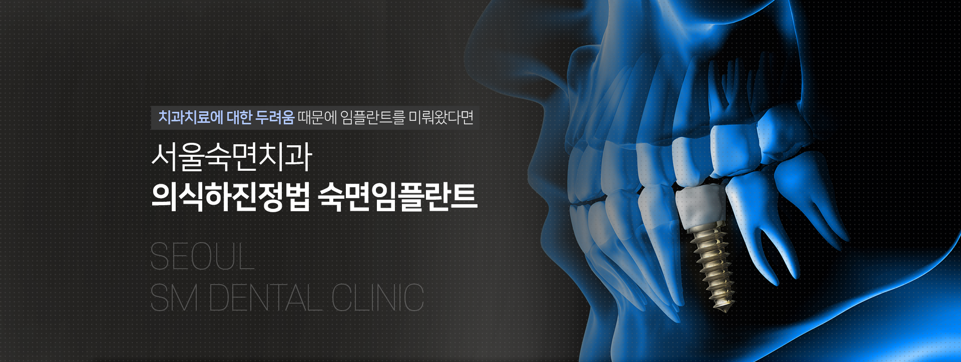 치과치료에-대한-두려움-때문에-임플란트를-미뤄왔다면-서울백련치과-수면임플란트